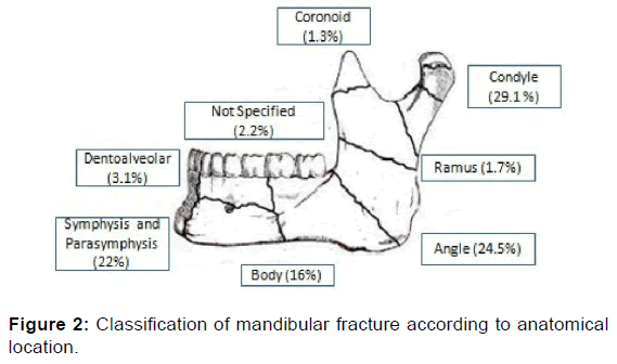 Newer Proposed Classification Mandibular Fractures: A
