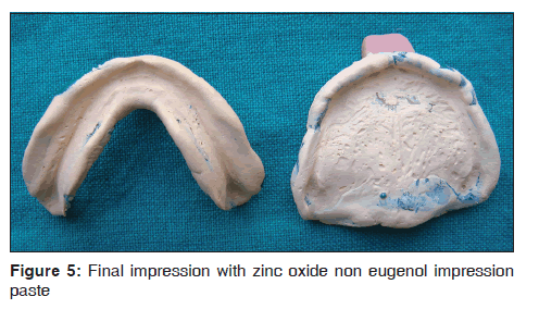 annals-medical-health-sciences-Final-impressions