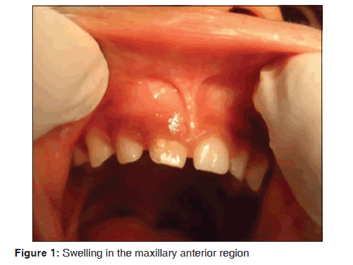 annals-medical-health-sciences-Swelling