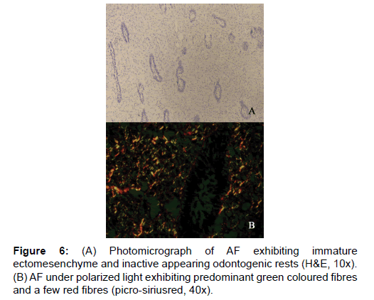 annals-medical-health-sciences-ectomesenchyme