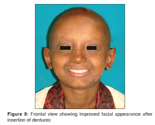 annals-medical-health-sciences-facial-appearance