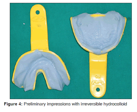 annals-medical-health-sciences-impressions