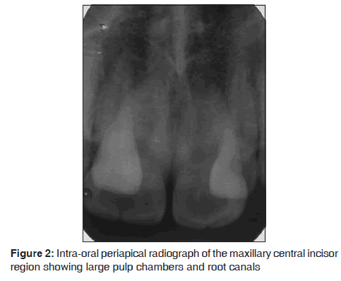 annals-medical-health-sciences-oral-periapical