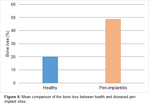 annals-medical-health-sciences-bone-loss
