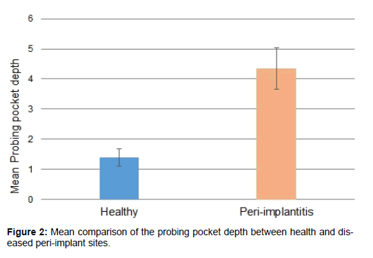 annals-medical-health-sciences-probing-pocket