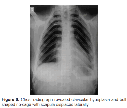 annals-medical-health-Chest-radiograph