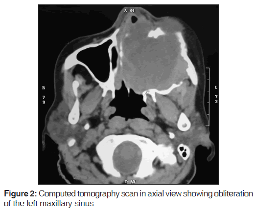 annals-medical-health-Computed-tomography