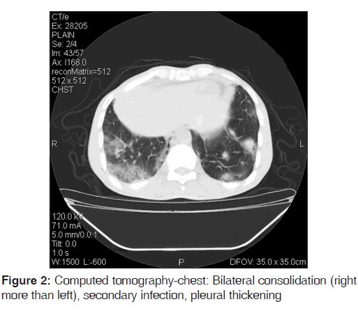 annals-medical-health-Computed-tomography