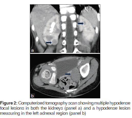 annals-medical-health-Computerised-tomography