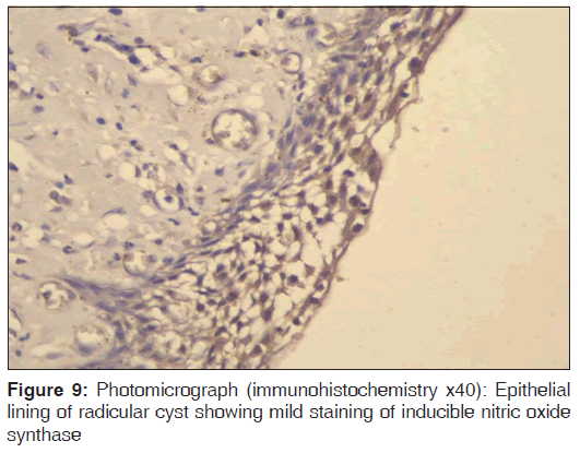 annals-medical-health-Epithelial-lining-radicular