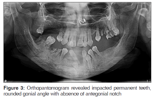 annals-medical-health-Lateral-cephalogram