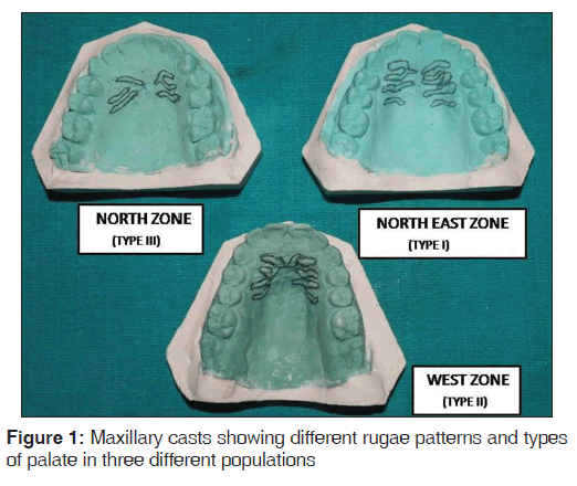 annals-medical-health-Maxillary-casts