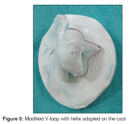 annals-medical-health-Modified-loop