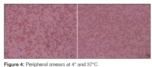 annals-medical-health-Peripheral-smears