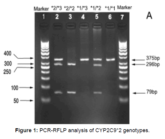 annals-medical-health-RFLP-analysis