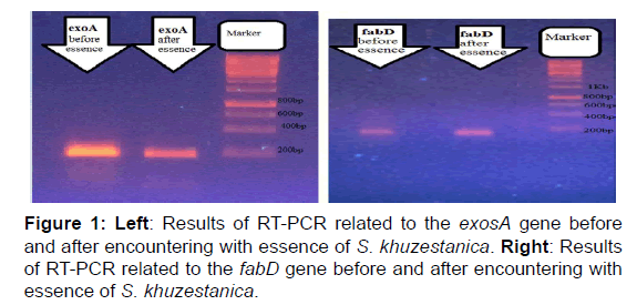 annals-medical-health-Results-RT-PCR