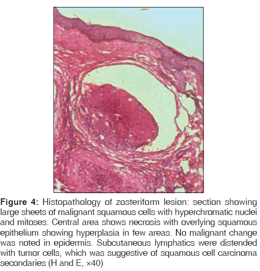 annals-medical-health-Subcutaneous-lymphatics