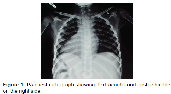 annals-medical-health-chest-radiograph