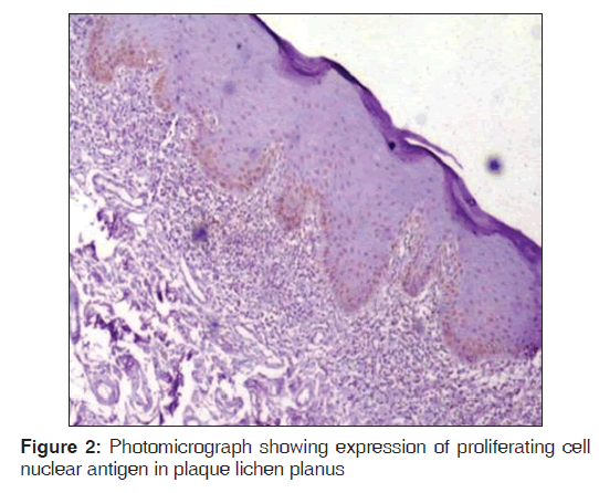 annals-medical-health-expression-proliferating