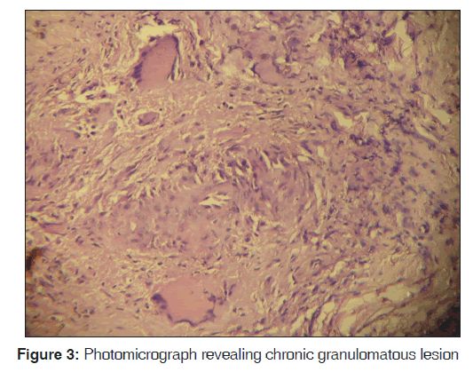 annals-medical-health-gingival-inflammation