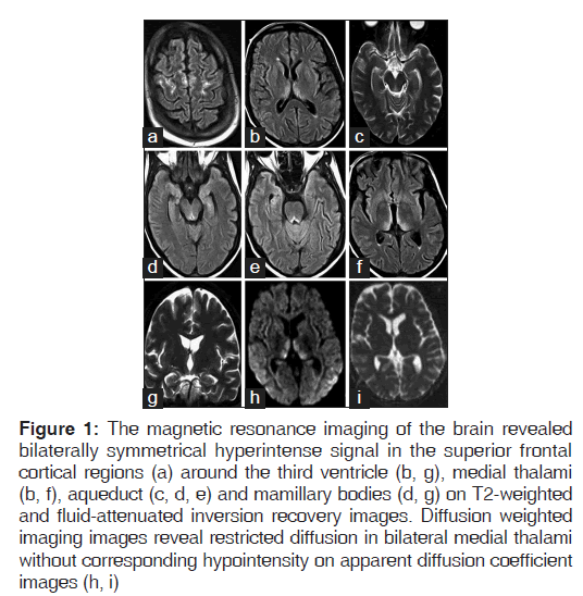 annals-medical-health-magnetic-resonance-imaging