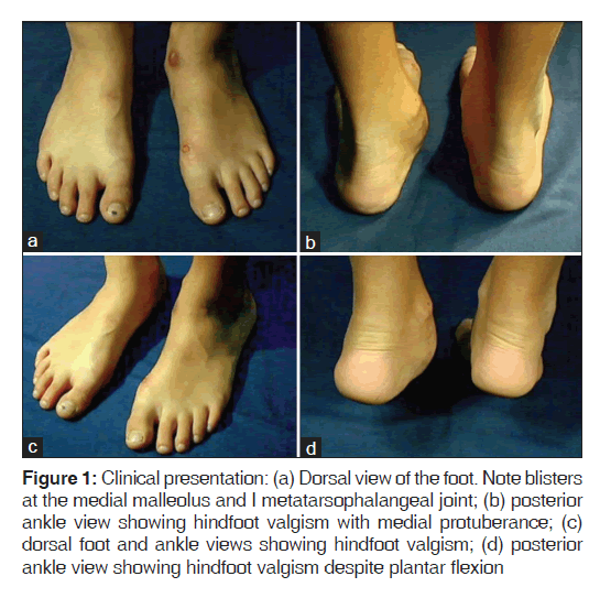 annals-medical-health-medial-malleolus