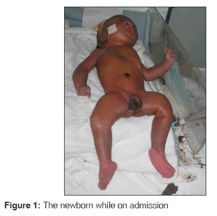 annals-medical-health-newborn-while-admission