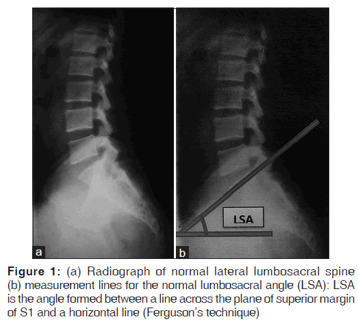 annals-medical-health-normal-lateral-lumbosacral