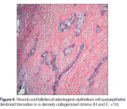 annals-medical-health-odontogenic-epithelium