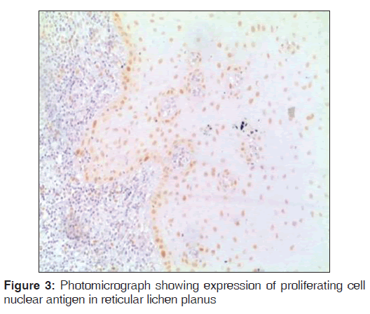 annals-medical-health-proliferating-cell