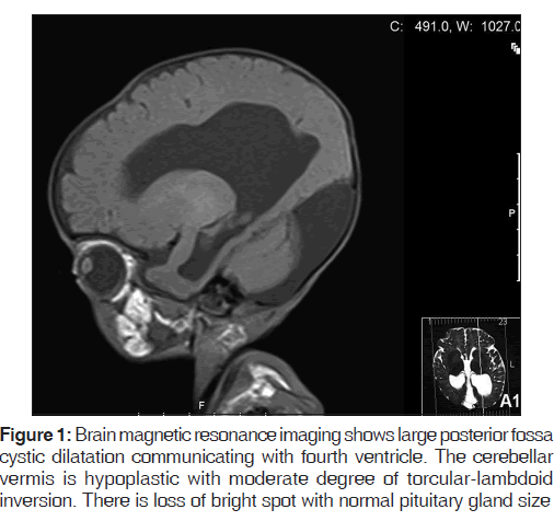 annals-medical-health-sciences-Brain-magnetic-resonance