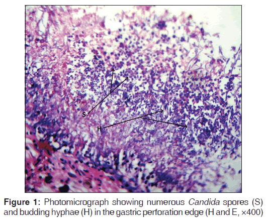 annals-medical-health-sciences-Candida-spores