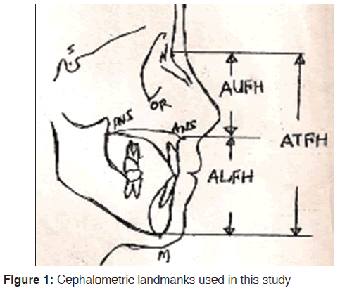 annals-medical-health-sciences-Cephalometric