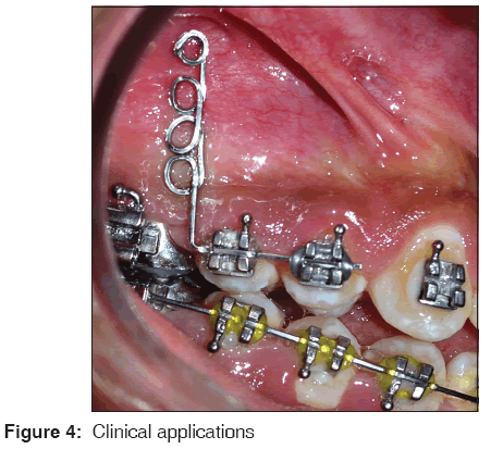 annals-medical-health-sciences-Clinical-application