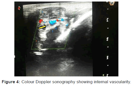 annals-medical-health-sciences-Colour-Doppler