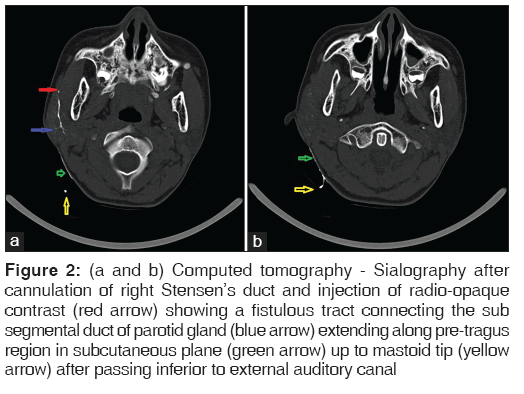 annals-medical-health-sciences-Computed-tomography
