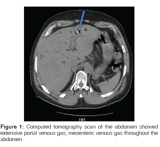 annals-medical-health-sciences-Computed-tomography