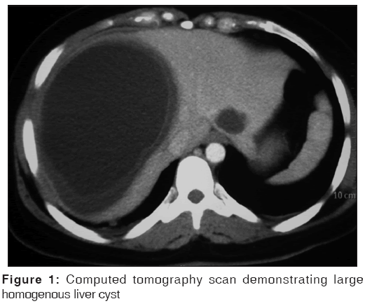 annals-medical-health-sciences-Computed-tomography