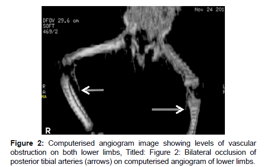 annals-medical-health-sciences-Computerised-angiogram-image