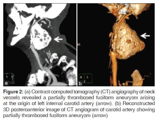 annals-medical-health-sciences-Contrast-computed-tomography