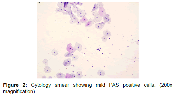 annals-medical-health-sciences-Cytology-smear