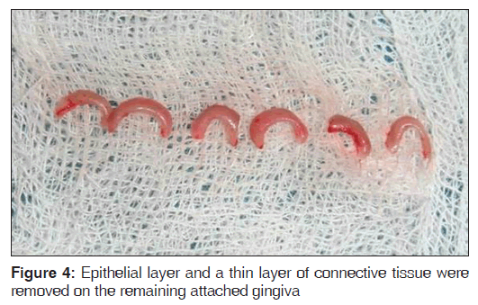 annals-medical-health-sciences-Epithelial-layer