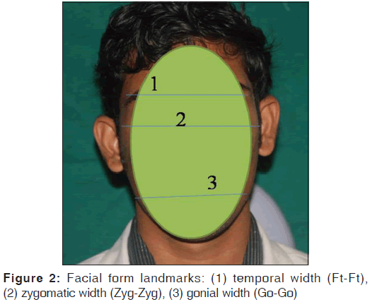 annals-medical-health-sciences-Facial-form