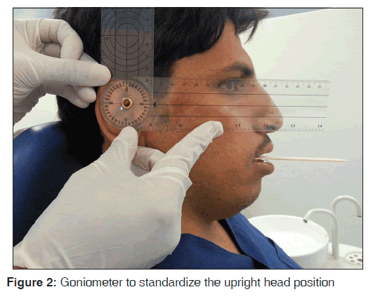 annals-medical-health-sciences-Goniometer