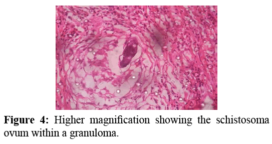 annals-medical-health-sciences-Higher-magnification