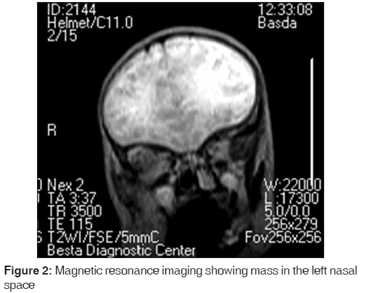 annals-medical-health-sciences-Magnetic-resonance