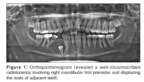 annals-medical-health-sciences-Orthopantomogram