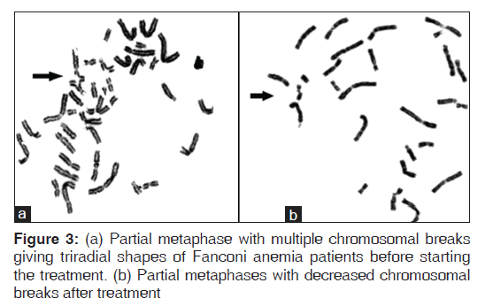 annals-medical-health-sciences-Partial-metaphase