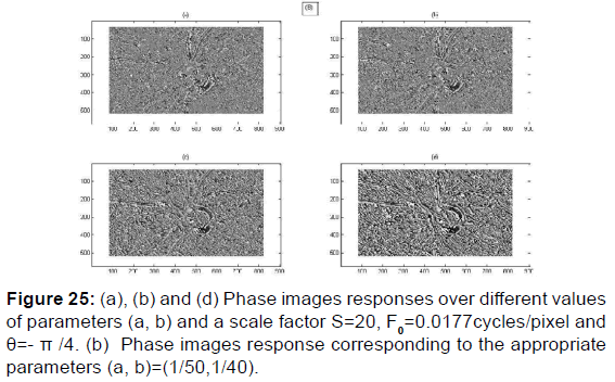 annals-medical-health-sciences-Phase-images