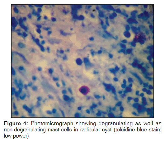 annals-medical-health-sciences-Photomicrograph